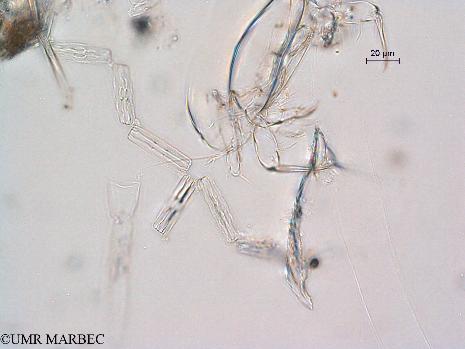 phyto/Scattered_Islands/all/COMMA April 2011/Grammatophora oceanica (ancien Diatoma sp2 -ancien Thalassionema sp6 -recomposé)(copy).jpg